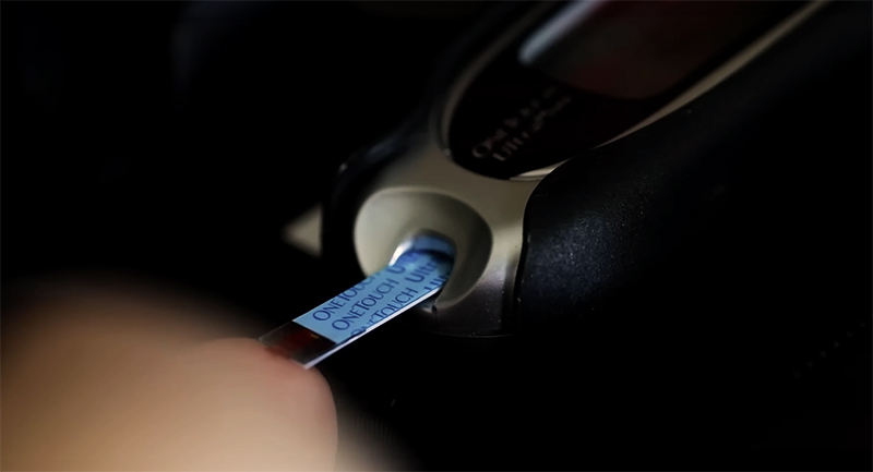 침습적 혈당 모니터링